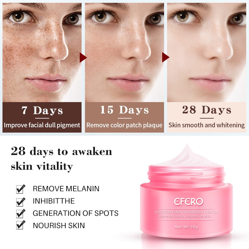 Skin Whitening Cream Freckle Cream Remove Acne Dark Pigment Spots Melanin Pimple Cream Face Cream Face Serum Skin Care - Gufetto Brand 